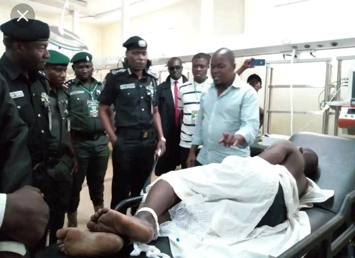 Rivers Police: The prime suspect of the explosion is still hospitalised under heavy security watch